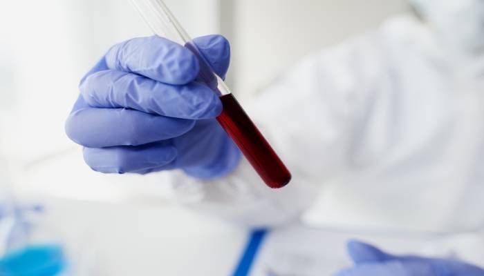 dispositivo de cierre vascular