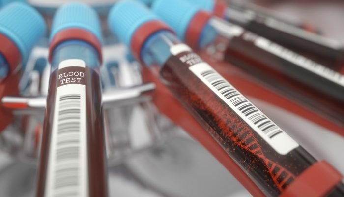 botellas de almacenamiento de vidrio