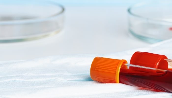 Tubos recolectores de sangre