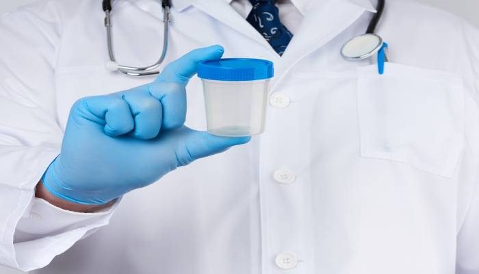 Frasco estéril para urocultivo