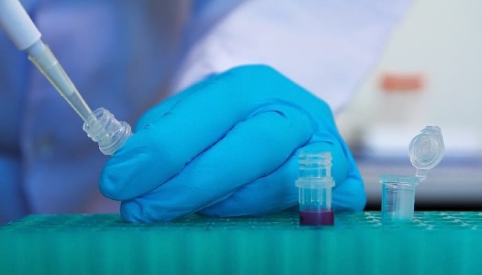 Pipetas de laboratorio